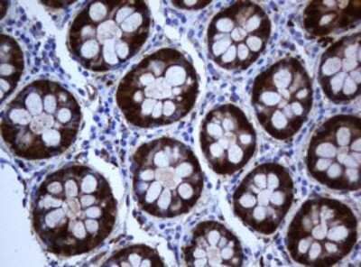 Immunohistochemistry: SELENBP1 Antibody (OTI3H1) [NBP2-45979]