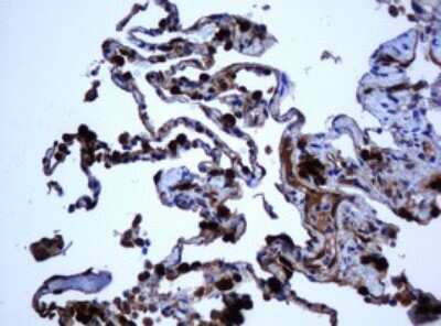 Immunohistochemistry: SELENBP1 Antibody (OTI3H1) [NBP2-45979]