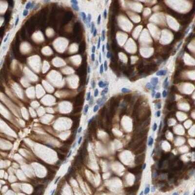 Immunohistochemistry-Paraffin: SELENBP1 Antibody [NBP1-83196]