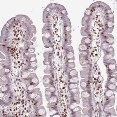 Immunohistochemistry-Paraffin: SELH Antibody [NBP2-14637]