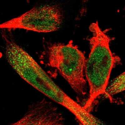 Immunocytochemistry/ Immunofluorescence: SELK Antibody [NBP1-86120]