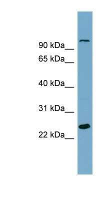 Western Blot: SEMA3D Antibody [NBP1-59505]