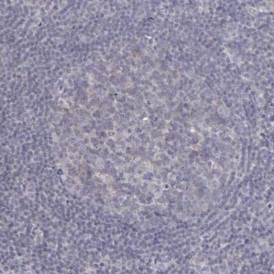 Immunohistochemistry-Paraffin: SEMA3G Antibody [NBP1-83881]