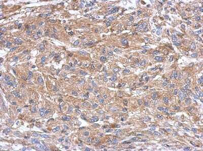 Immunohistochemistry-Paraffin: Semaphorin 4B Antibody [NBP2-19299]