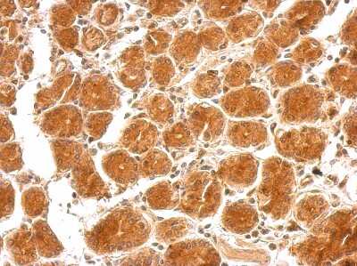 Immunohistochemistry-Paraffin: Semaphorin 4B Antibody [NBP2-19299]