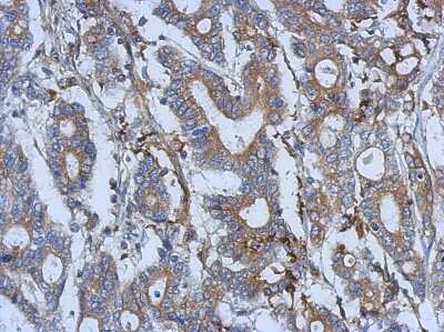 Immunohistochemistry-Paraffin: Semaphorin 5A Antibody [NBP2-20291]