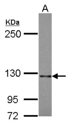 Western Blot: Semaphorin 5A Antibody [NBP2-20291]
