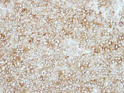 Immunohistochemistry-Paraffin: Semaphorin 6C Antibody [NBP2-15114]