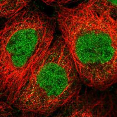 Immunocytochemistry/ Immunofluorescence: SENP1 Antibody [NBP2-55420]