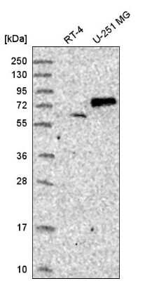 Western Blot: SENP1 Antibody [NBP2-55420]