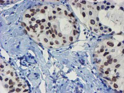 Immunohistochemistry-Paraffin: SENP2 Antibody (OTI3D3) [NBP2-03852]