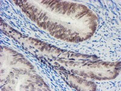 Immunohistochemistry-Paraffin: SENP2 Antibody (OTI3D3) [NBP2-03852]