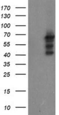 Western Blot: SENP2 Antibody (OTI3D3) [NBP2-03852]