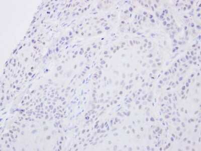 Immunohistochemistry-Paraffin: SENP2 Antibody [NBP1-31217]