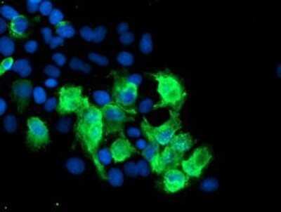 Immunocytochemistry/ Immunofluorescence: SENP2 Antibody (OTI3D3) - Azide and BSA Free [NBP2-74062]