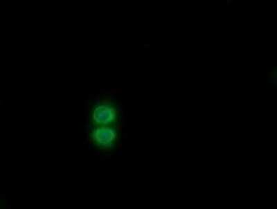 Immunocytochemistry/ Immunofluorescence: SENP2 Antibody (OTI4B3) - Azide and BSA Free [NBP2-74060]