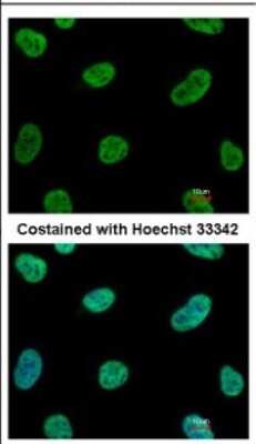 Immunocytochemistry/ Immunofluorescence: SENP3 Antibody [NBP2-20294]