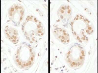 Immunohistochemistry: SENP3 Antibody [NBP1-71895]