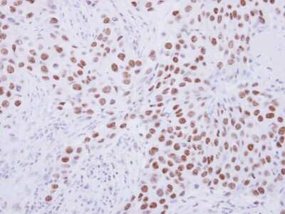 Immunohistochemistry-Paraffin: SENP3 Antibody [NBP2-20294]