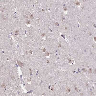 Immunohistochemistry-Paraffin: SENP3 Antibody [NBP2-32525]