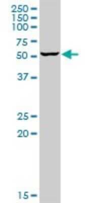 Western Blot: SENP3 Antibody [H00026168-D01P]