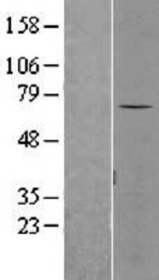 Western Blot: SENP3 Overexpression Lysate [NBL1-15810]