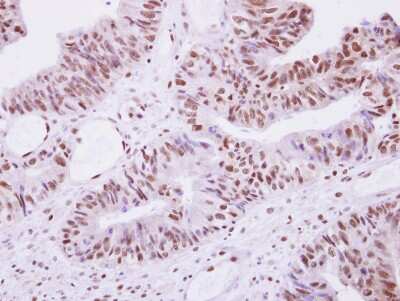 Immunohistochemistry-Paraffin: SEPHS1 Antibody [NBP1-32312]