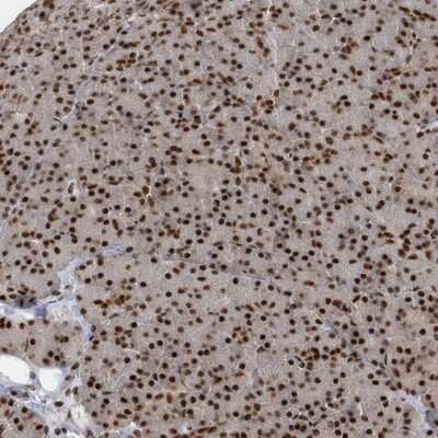 Immunohistochemistry-Paraffin: SEPHS1 Antibody [NBP1-87008]