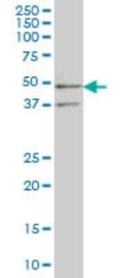 Western Blot: SEPHS2 Antibody (2G9) [H00022928-M02]