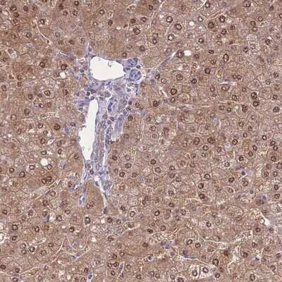 Immunohistochemistry-Paraffin: SEPHS2 Antibody [NBP2-13293]