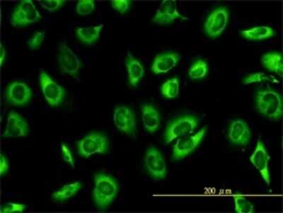 Immunocytochemistry/ Immunofluorescence: SERBP1 Antibody (1D2-2E9) [H00026135-M01]