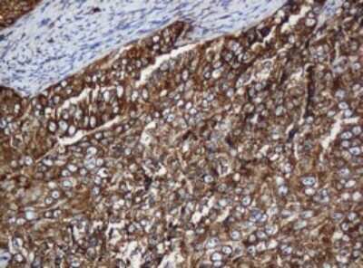 Immunohistochemistry: SERBP1 Antibody (OTI5G2) [NBP2-45763]