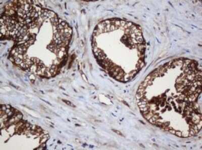 Immunohistochemistry: SERBP1 Antibody (OTI5G2) [NBP2-45763]