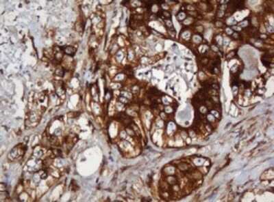 Immunohistochemistry: SERBP1 Antibody (OTI5G2) [NBP2-45763]