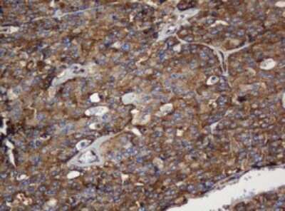 Immunohistochemistry: SERBP1 Antibody (OTI5G2) [NBP2-45763]