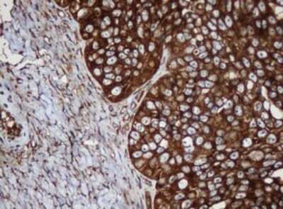 Immunohistochemistry: SERBP1 Antibody (OTI5G2) [NBP2-45763]