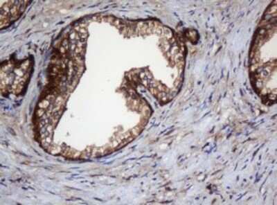 Immunohistochemistry: SERBP1 Antibody (OTI5G2) [NBP2-45763]