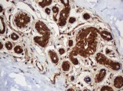 Immunohistochemistry: SERBP1 Antibody (OTI5G2) [NBP2-45763]