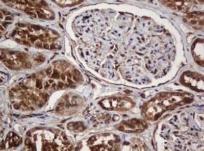 Immunohistochemistry: SERBP1 Antibody (OTI5G2) [NBP2-45763]