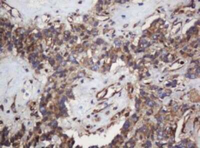 Immunohistochemistry: SERBP1 Antibody (OTI5G2) [NBP2-45763]
