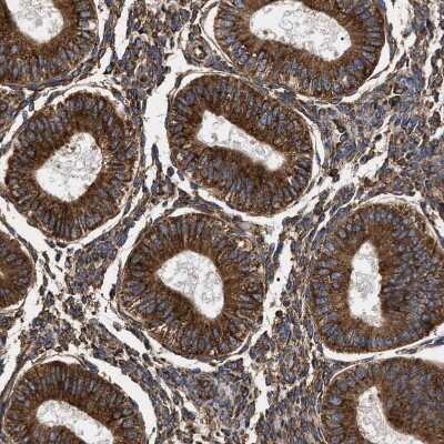 Immunohistochemistry-Paraffin: SERBP1 Antibody [NBP1-85660]
