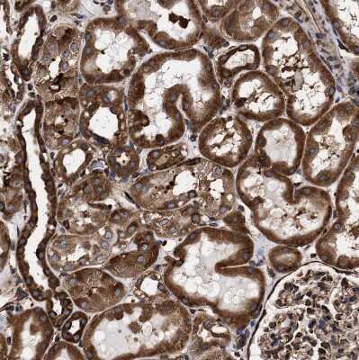 Immunohistochemistry-Paraffin: SERBP1 Antibody [NBP1-85660]