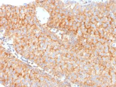 Immunohistochemistry-Paraffin: SERBP1 Antibody (SERBP1/3491) - Azide and BSA Free [NBP3-08560]