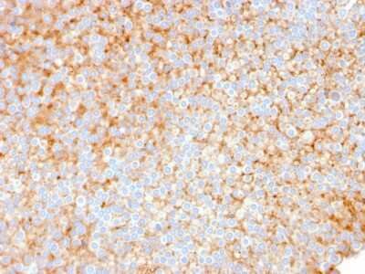 Immunohistochemistry-Paraffin: SERBP1 Antibody (SERBP1/3491) - Azide and BSA Free [NBP3-08560]