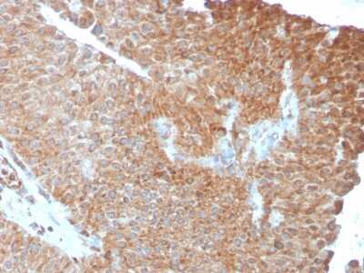 Immunohistochemistry-Paraffin: SERBP1 Antibody (SERBP1/3493) [NBP2-79805]