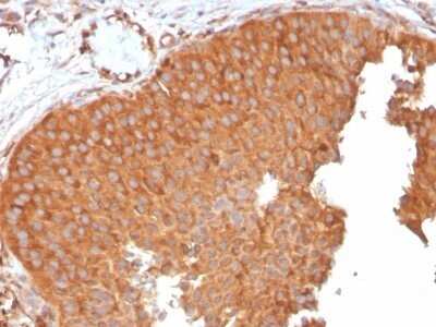 Immunohistochemistry-Paraffin: SERBP1 Antibody (SERBP1/3496) - Azide and BSA Free [NBP2-79844]