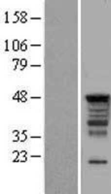 Western Blot: SERBP1 Overexpression Lysate [NBL1-15823]
