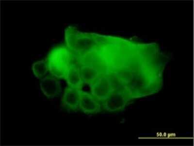 Immunocytochemistry/ Immunofluorescence: SERCA1 ATPase Antibody (1B11) [H00000487-M01]