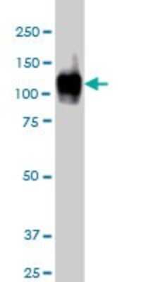 Western Blot: SERCA1 ATPase Antibody (1B11) [H00000487-M01]