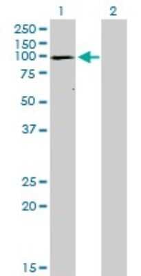 Western Blot: SERCA1 ATPase Antibody (1B11) [H00000487-M01]